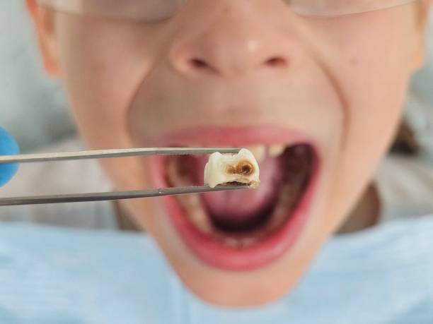 Best Emergency Dentist for Special Needs Patients in Clanton, AL