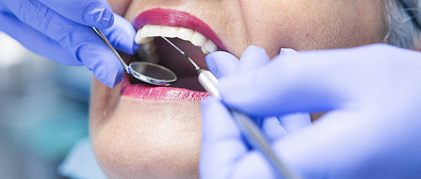 Best Emergency Dental Care for Abscessed Tooth in Clanton, AL